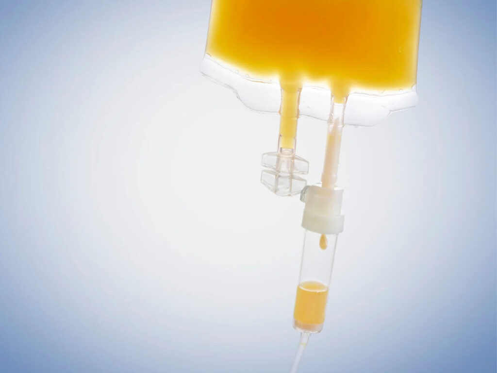 Close-up of an IV drip bag filled with a yellow liquid against a light blue gradient background.